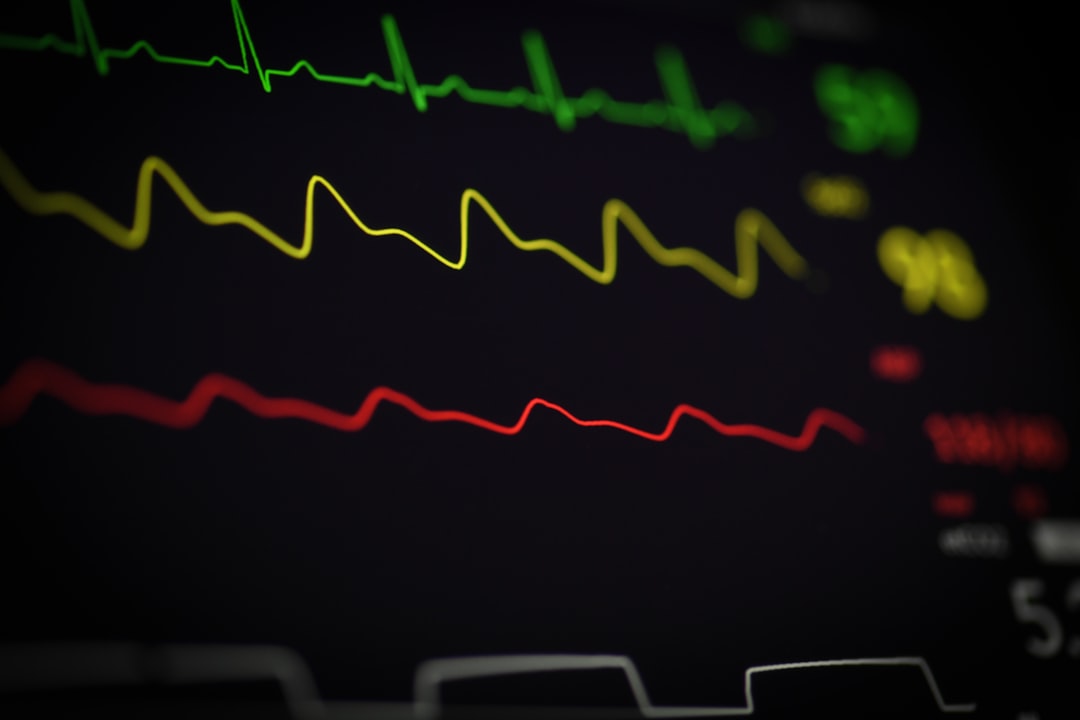 Cardiac rhythm displayed on a hospital ECG monitor during an ACLS scenario
