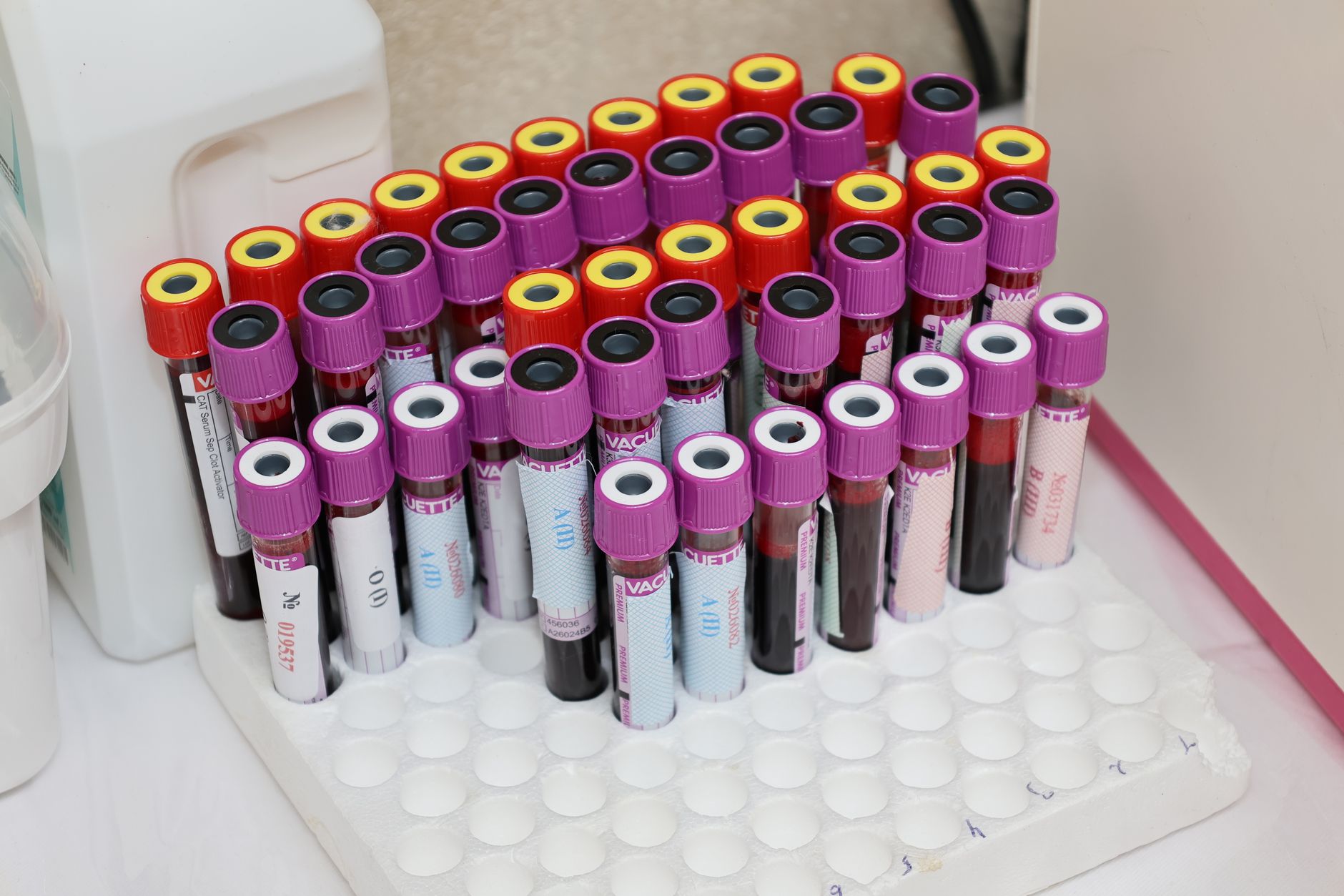 Nursing Lab Values: High-Yield Ranges & Critical Flags