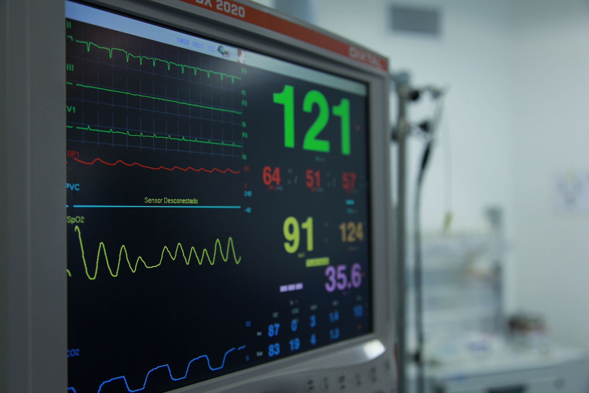 Cardiac monitor used to assess critical potassium and dysrhythmia risk